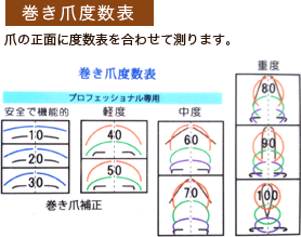 巻き爪度数表